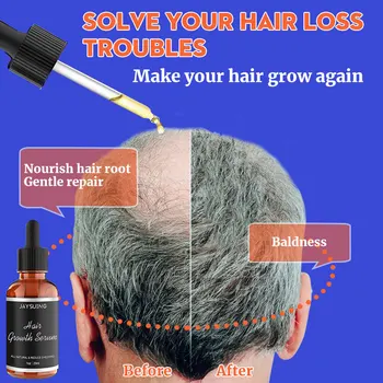 Жидкая сыворотка для восстановления роста волос, эффективная против выпадения, для придания волосам объема и густоты, лечебная эссенция, Восстанавливающий массаж кожи головы, средство по уходу за волосами